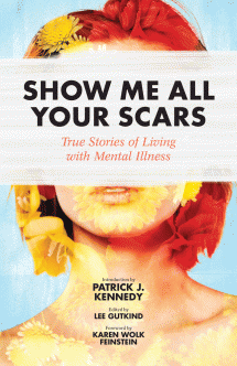 ShowMeAllYourScars_Cover_F